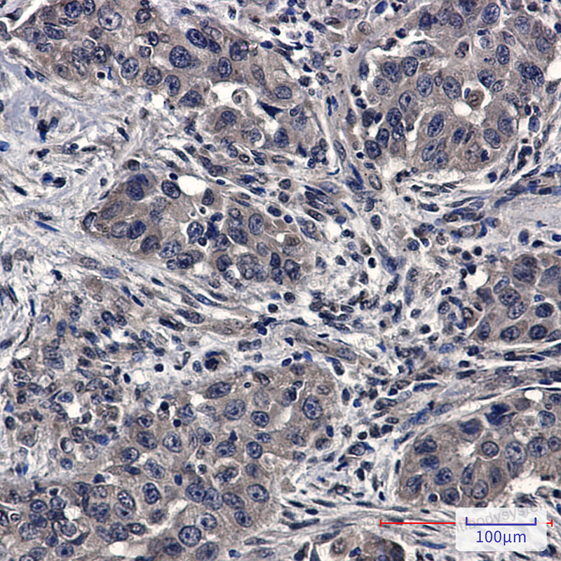 Anti-UBE2D1 Antibody (R1Y34)