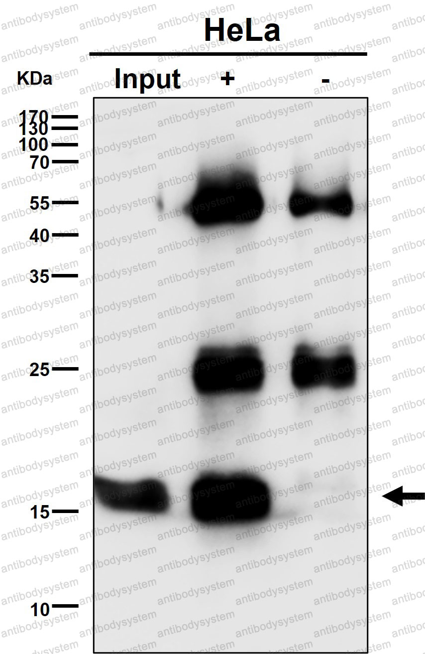 Anti-UBE2D1 Antibody (R1Y33)