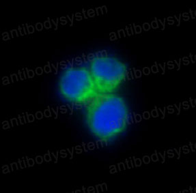 Anti-CD198/CCR8 Antibody (R1Y35)