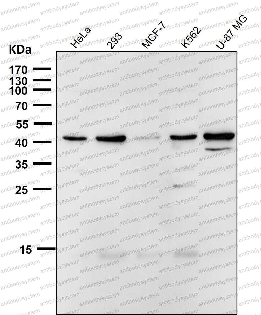 Anti-CDw199/CCR9 Antibody (R1A28)