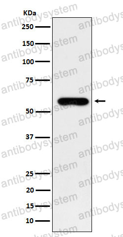 Anti-SUOX Antibody (R1Y36)