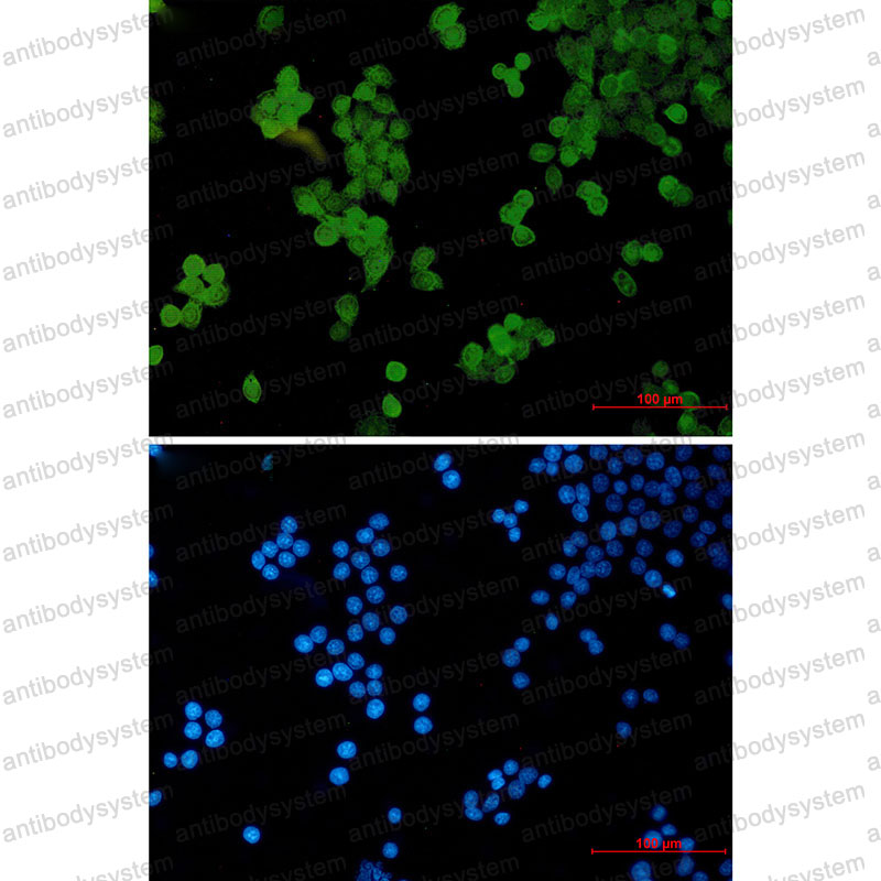 Anti-STAT5B Antibody (R1Y37)