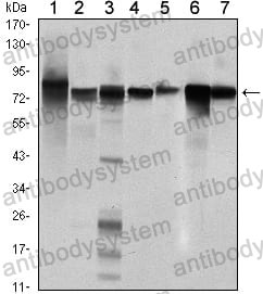 Anti-STAT5B Antibody (R3M68)