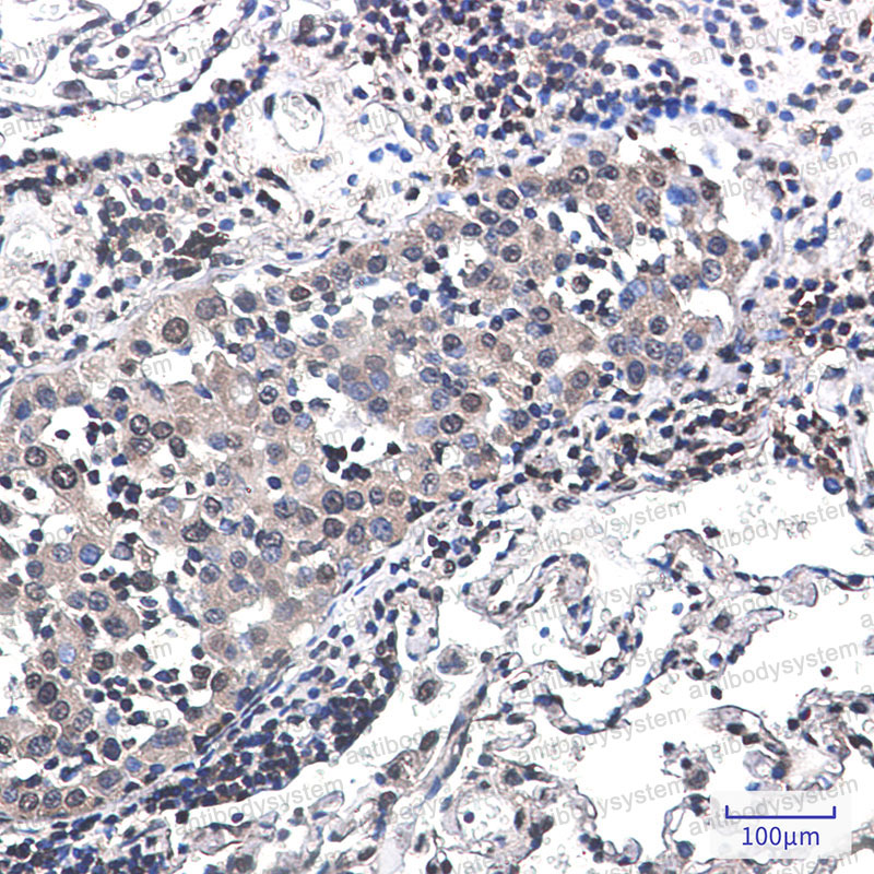 Anti-RPS6KA3 Antibody (R1Y40)
