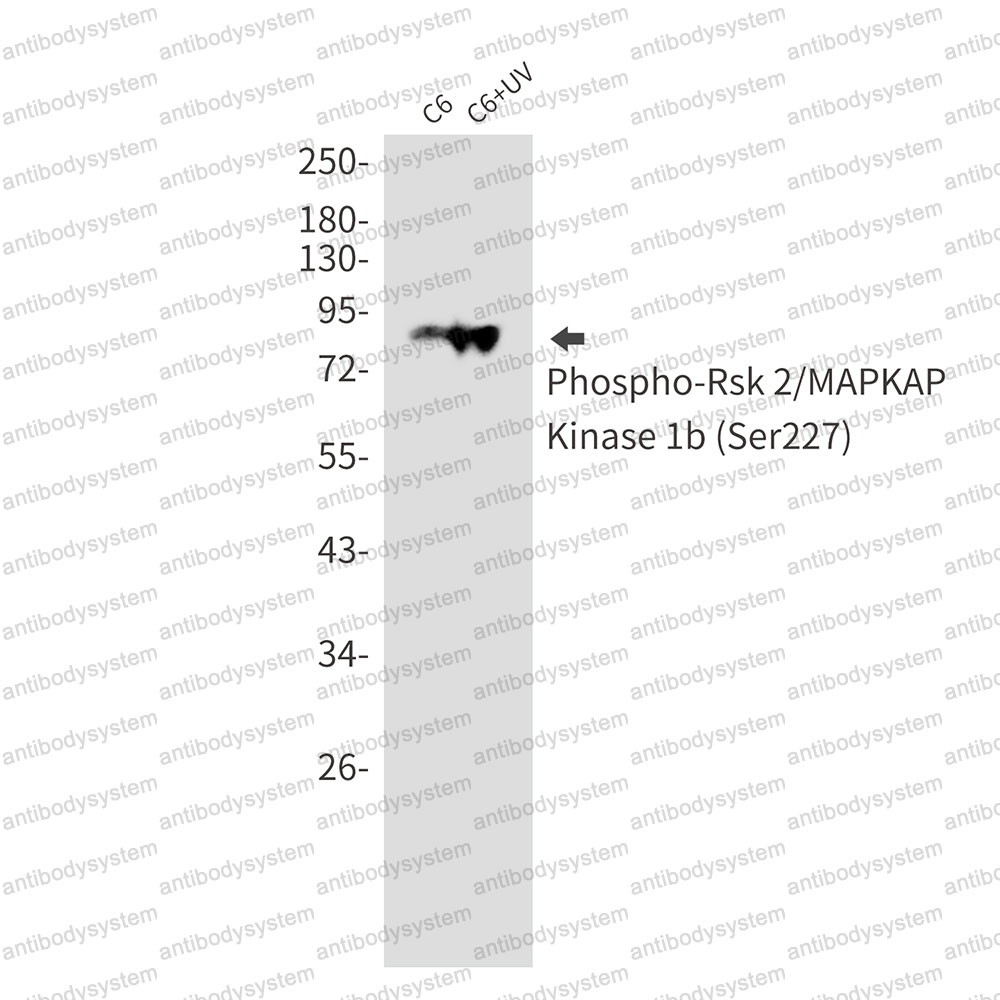 Anti-Phospho-RPS6KA3/RSK2 (Ser227) Antibody (R1Y39)