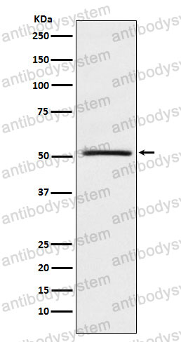 Anti-NR0B1 Antibody (R1Y41)