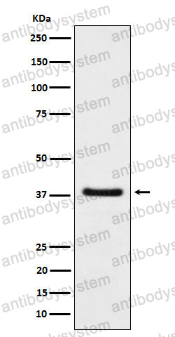 Anti-HDGF Antibody (R1Y42)