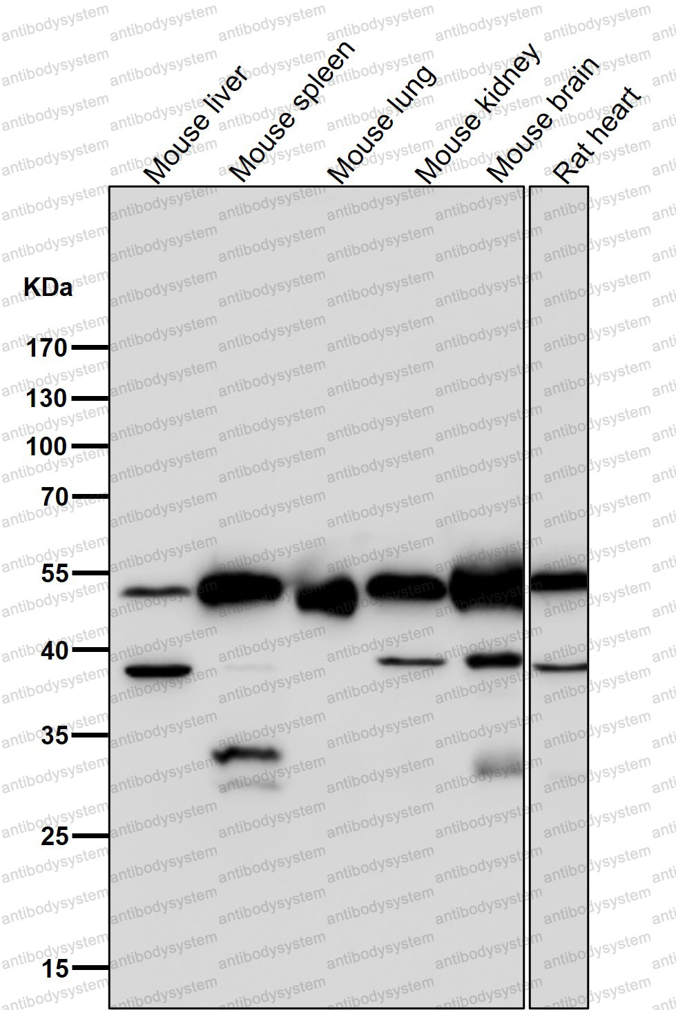 Anti-LUM/Lumican Antibody (R1Y44)