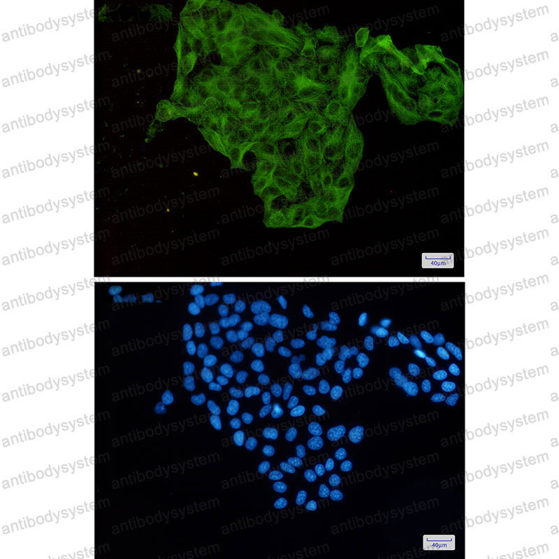 Anti-LUM/Lumican Antibody (R1Y45)