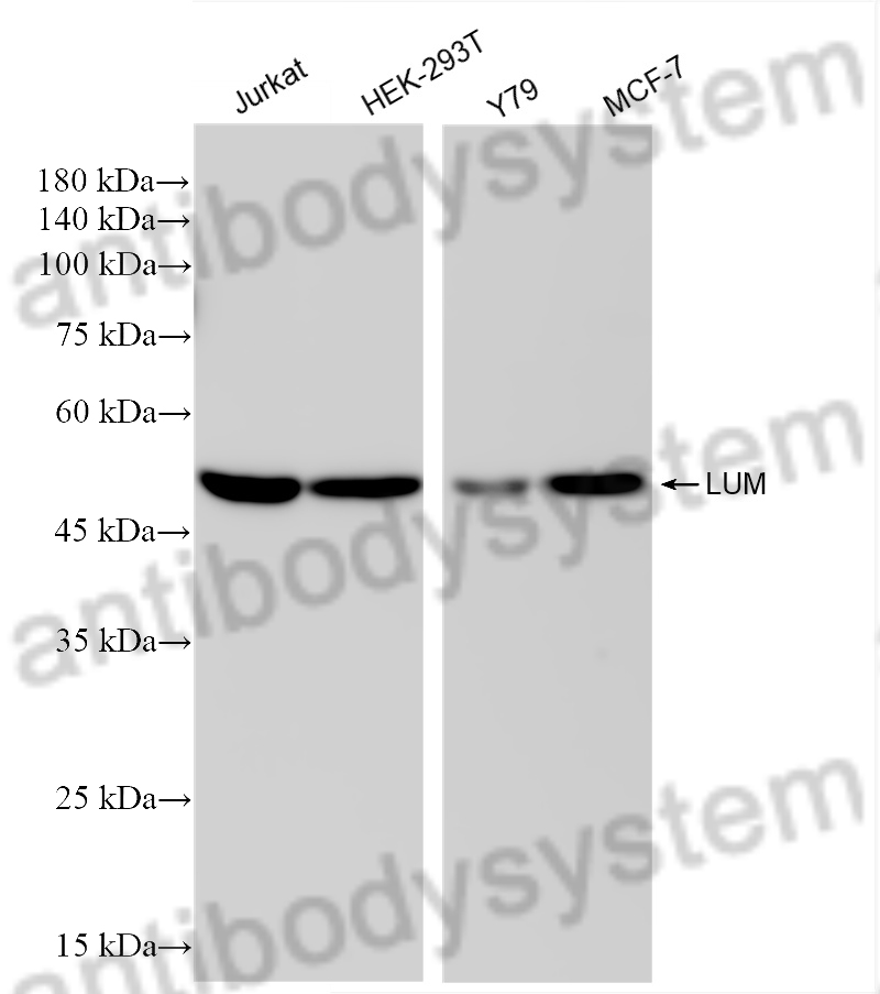 Anti-Human LUM/Lumican Antibody (R4D87)