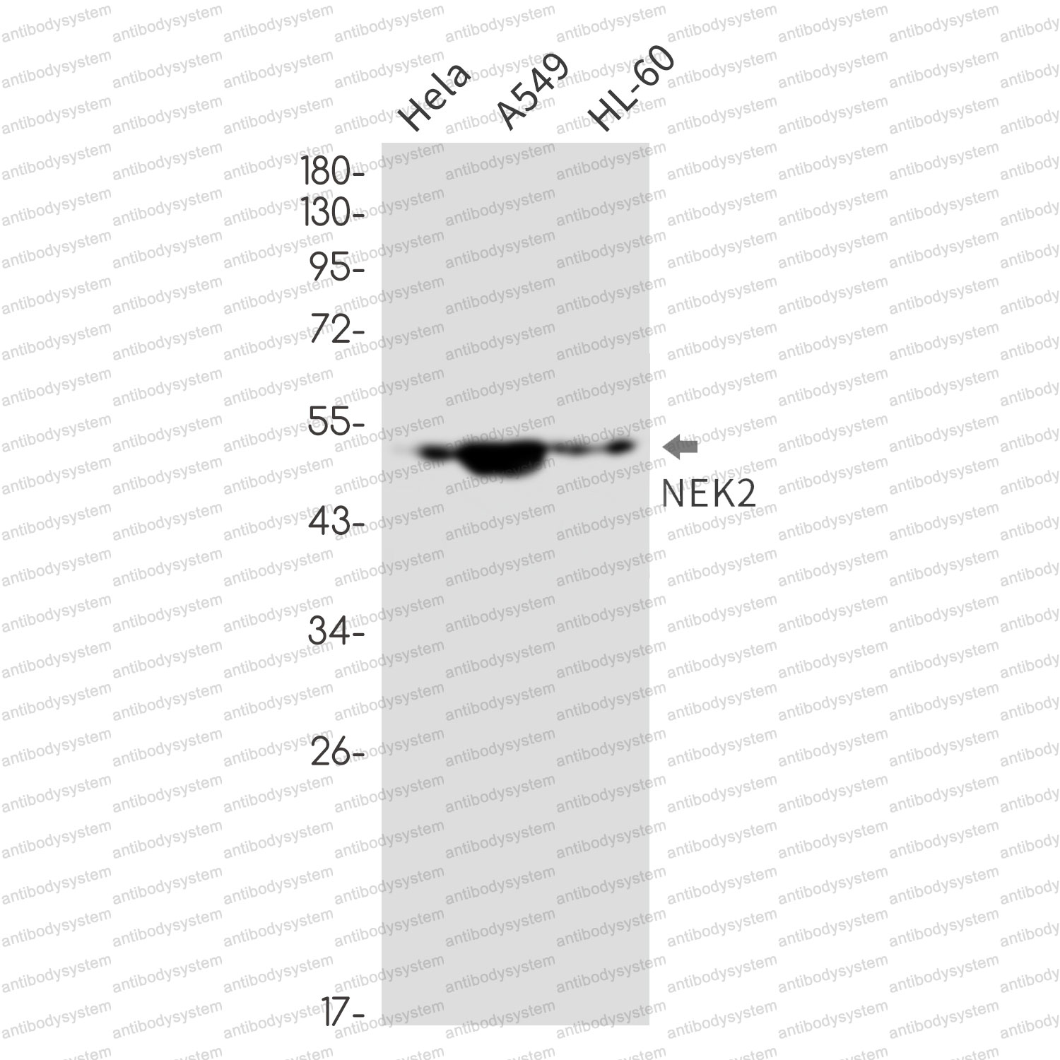 Anti-NEK2 Antibody (R1Y50)