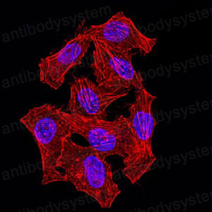 Immunofluorescence for Anti-NAGR1/HNRNPM Antibody (R3M74) ?>