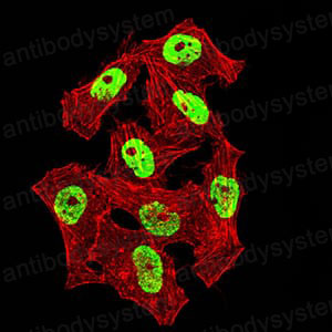 Immunofluorescence for Anti-NAGR1/HNRNPM Antibody (R3M74) ?>