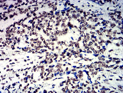 Immunohistochemical for Anti-NAGR1/HNRNPM Antibody (R3M74) ?>