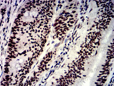 Immunohistochemical for Anti-NAGR1/HNRNPM Antibody (R3M74) ?>