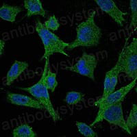 Immunofluorescence for Anti-MAP2K6 Antibody (R3M79) ?>