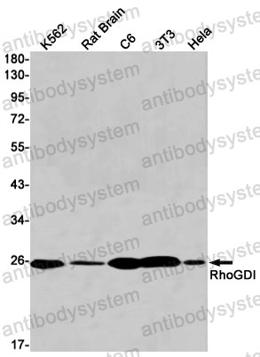 Anti-ARHGDIA Antibody (R1Y56)