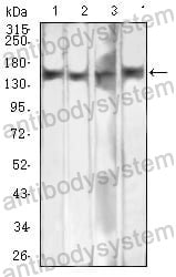 Western blot for Anti-MSH6 Antibody (R3M86) ?>