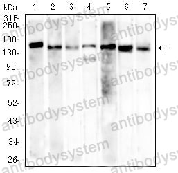 Western blot for Anti-MSH6 Antibody (R3M87) ?>