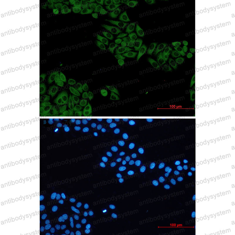 Anti-VAV2 Antibody (R1Y65)