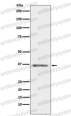 Anti-STC1 Antibody (R1Y70)