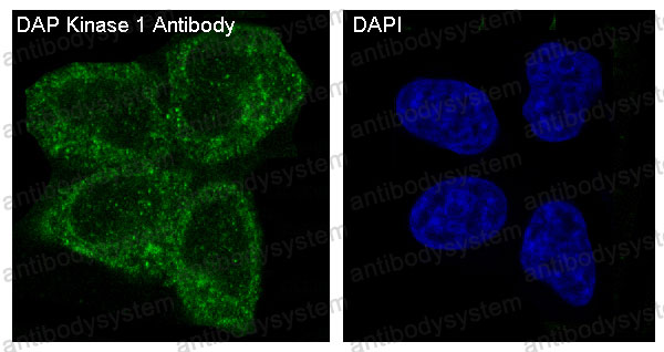 Anti-DAPK1 Antibody (R1B14)