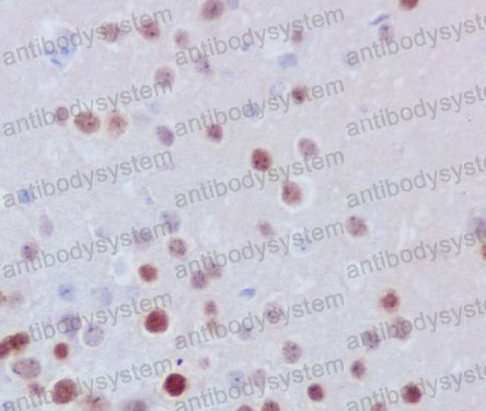 Anti-FOSB Antibody (R1C07)