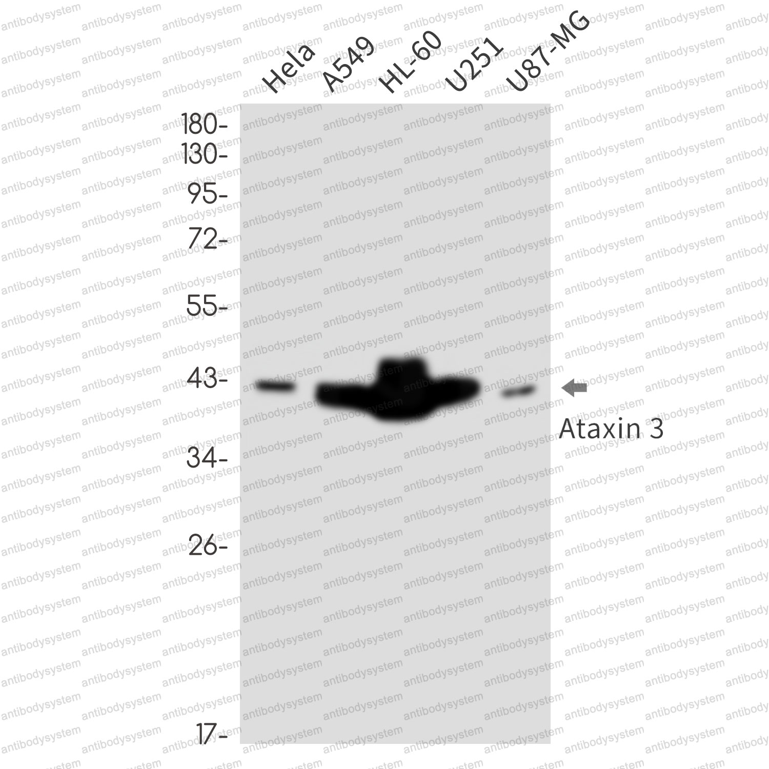 Anti-ATXN3 Antibody (R1Y86)