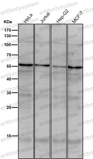 Anti-TERF1 Antibody (R1Y88)