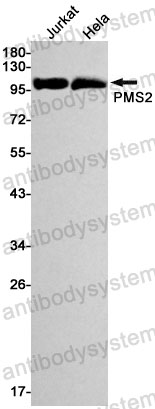 Anti-PMS2 Antibody (R1Y89)