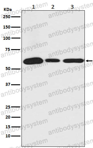 Anti-USP14 Antibody (R1Y90)