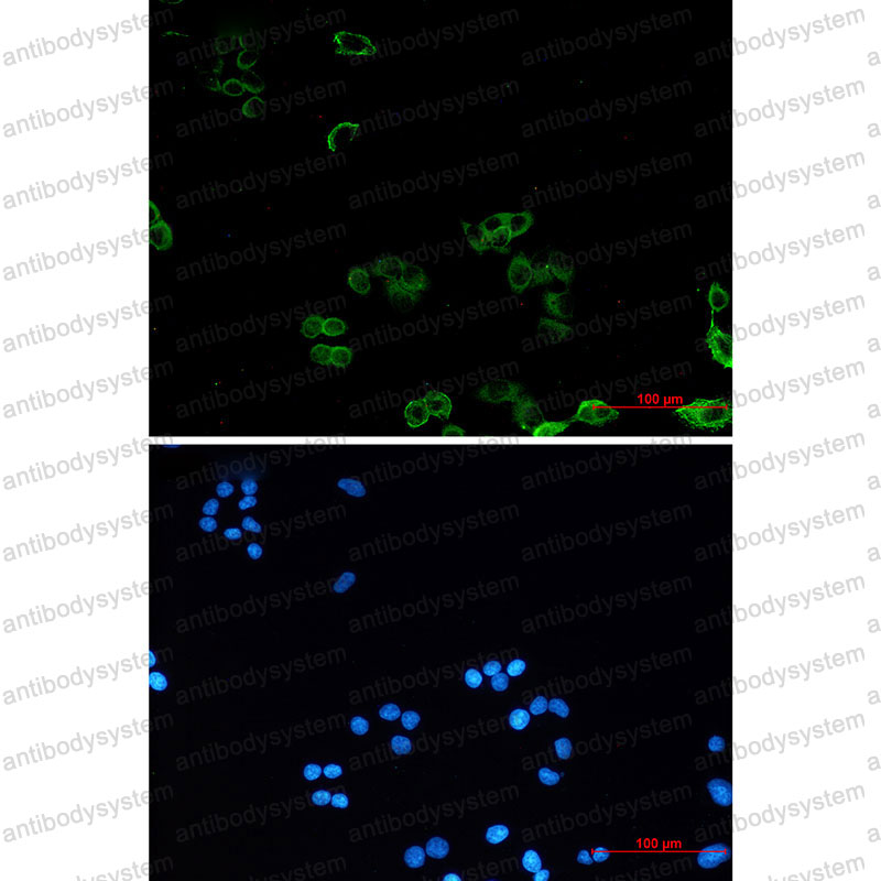 Anti-PRKAG1 Antibody (R1Y92)