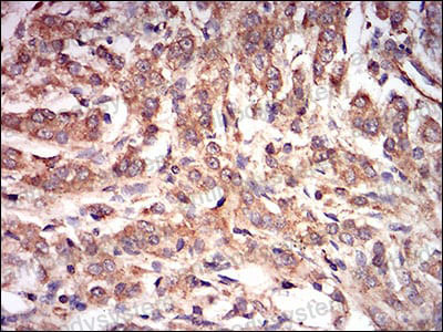 Immunohistochemical for Anti-PRKAG1 Antibody (R3N16) ?>