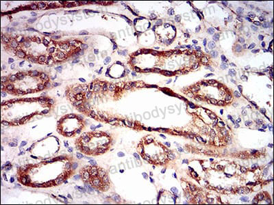Immunohistochemical for Anti-PRKAG1 Antibody (R3N16) ?>