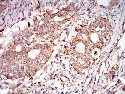 Immunohistochemical for Anti-PRKAG1 Antibody (R3N17) ?>
