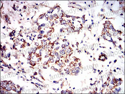 Immunohistochemical for Anti-PRKAG1 Antibody (R3N17) ?>
