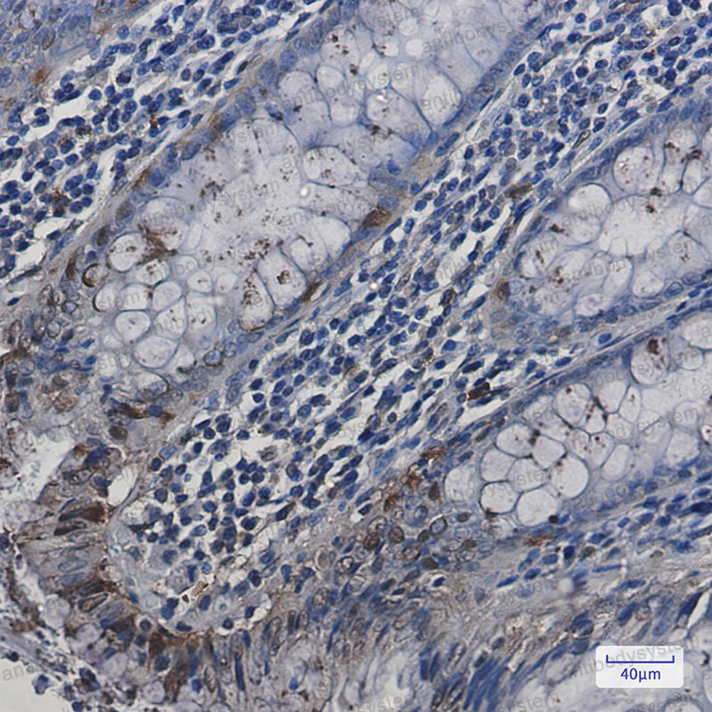 Anti-HSPA2 Antibody (R1Y96)