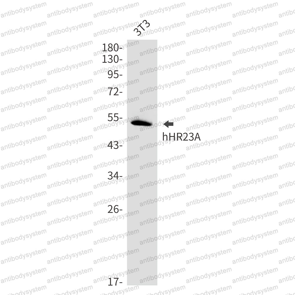 Anti-RAD23A Antibody (R1Y98)