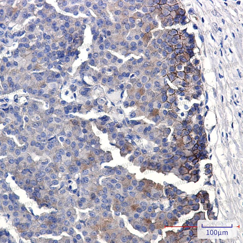 Anti-EPHB4 Antibody (R1Y99)