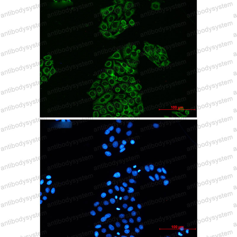 Anti-AK2 Antibody (R1Z02)