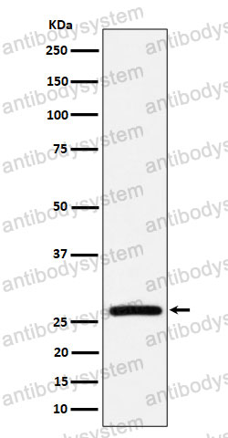 Anti-AK2 Antibody (R1Z01)