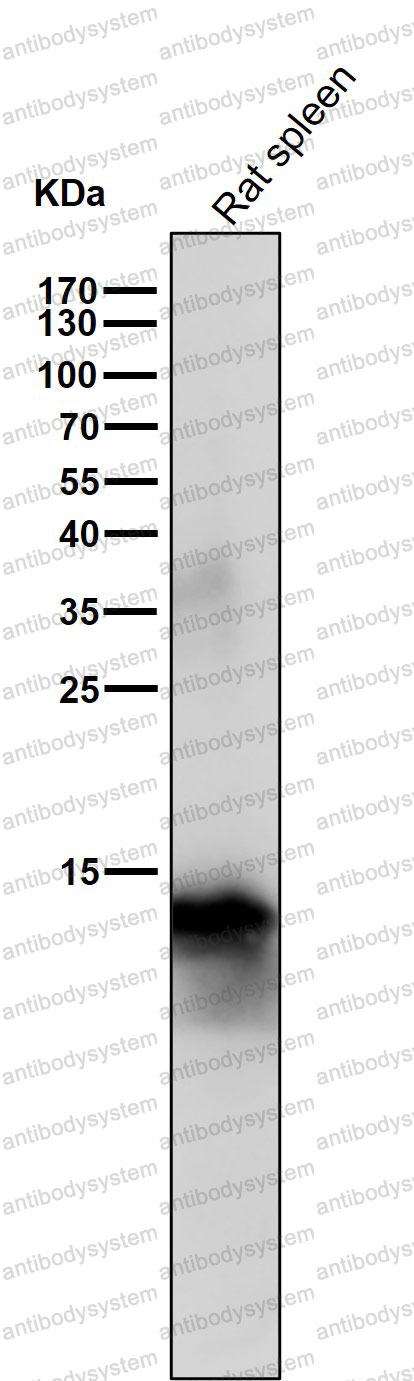 Anti-AIF1/IBA1 Antibody (R1Z06)
