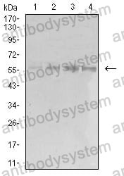 Western blot for Anti-EIF5 Antibody (R3N32) ?>