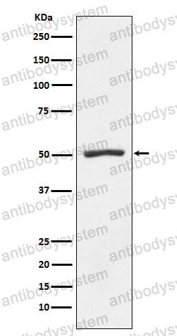 Anti-PSMD4 Antibody (R1Z09)