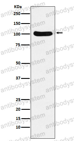 Anti-CSE1L Antibody (R1Z11)