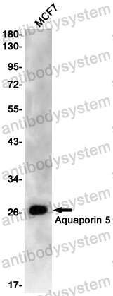 Anti-AQP5 Antibody (R1Z14)