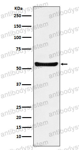 Anti-F2RL1/PAR-2 Antibody (R1Z16)