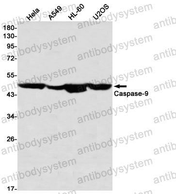 Anti-CASP9/Caspase 9 Antibody (R1Z27)