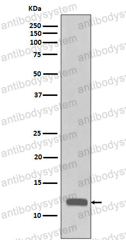 Anti-CCL23/MIP-3/MPIF-1 Antibody (R1Z40)