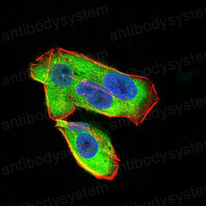 Immunofluorescence for Anti-UCP2 Antibody (R3N46) ?>